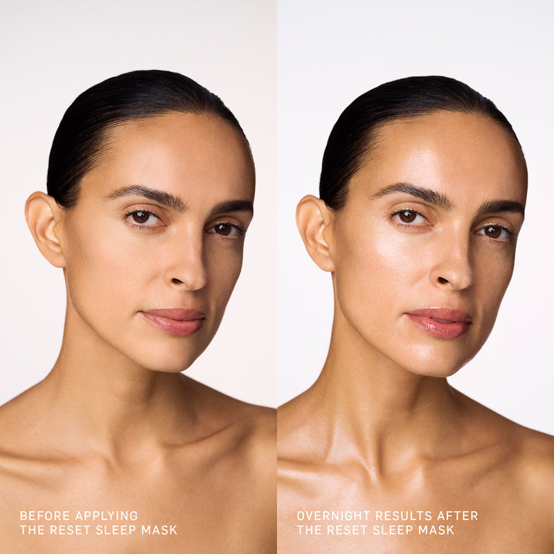 Reset Sleep Mask Before and After Image 7